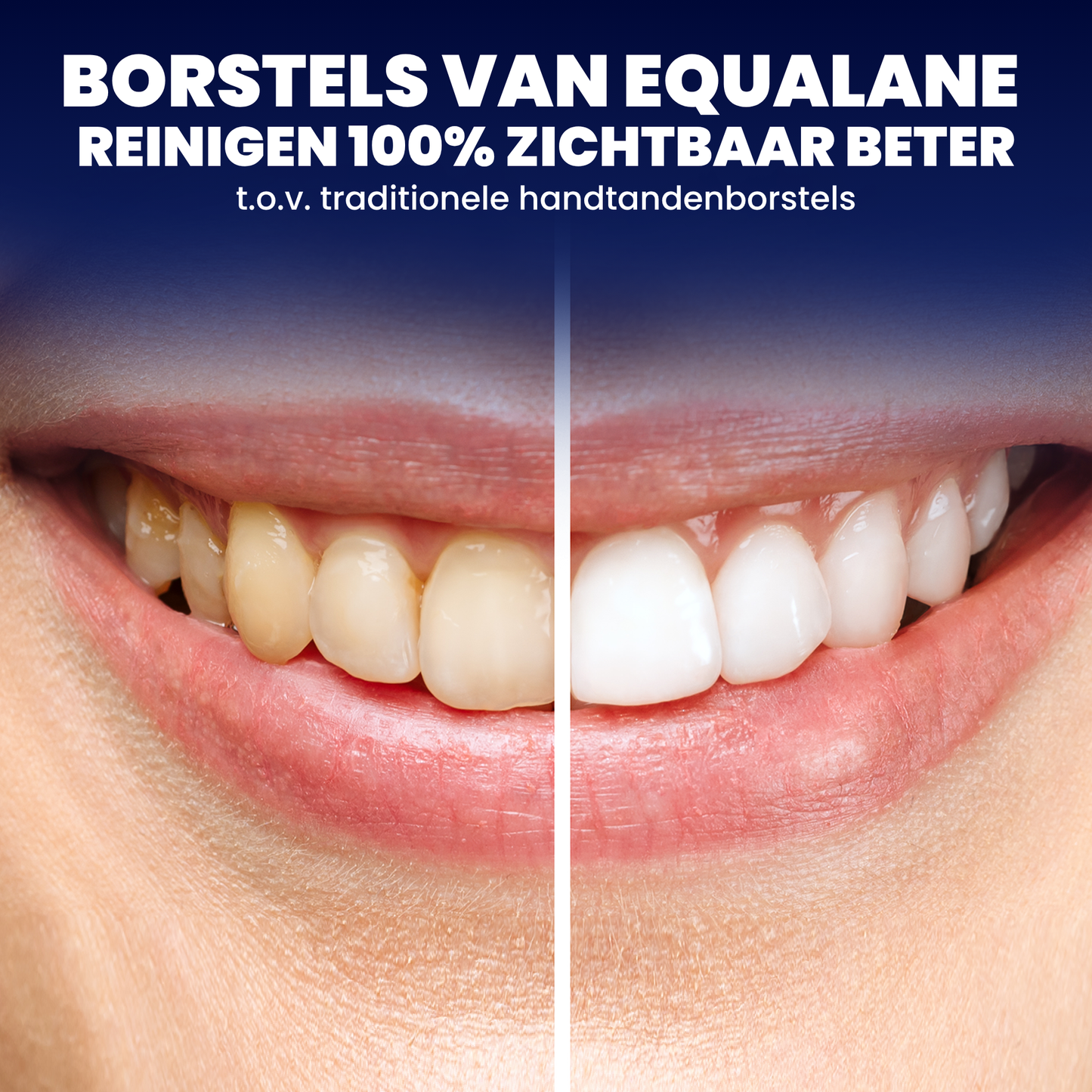 Opzetborstels geschikt voor Oral-B iO - Schuine Borstelharen - Zwart - 40 Stuks
